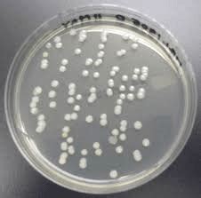 Heterotrophic Plate Count: What is HPC and when is the right time to.